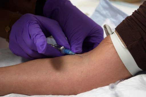A closer look at the unapproved peptide injections promoted by influencers and celebrities