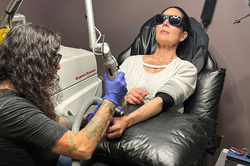 If you want that tattoo erased it’s going to hurt and it’s going to cost you
